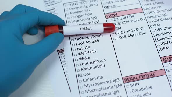 HIV, Doctor Checking Disease in Lab Blank, Showing Blood Sample, Awareness