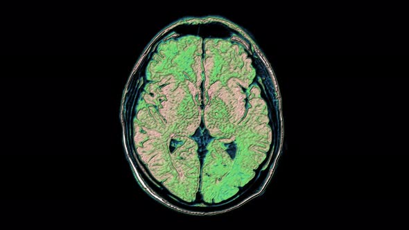 Bulk Multicolored MRI Scans of the Brain and Head To Detect Tumors. Diagnostic Medical Tool