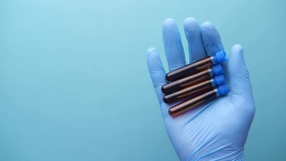 Hand in Blue Medical Gloves Holding Blood Test Tube