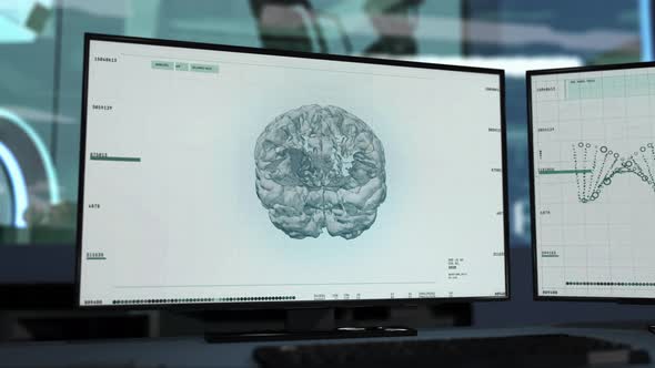Software Finding brain tumor to complete the illness diagnosis of a patient alt