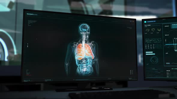 X-Ray Image Of Human's Body To Be Analyzed For A Diagnose By Medical Software alt