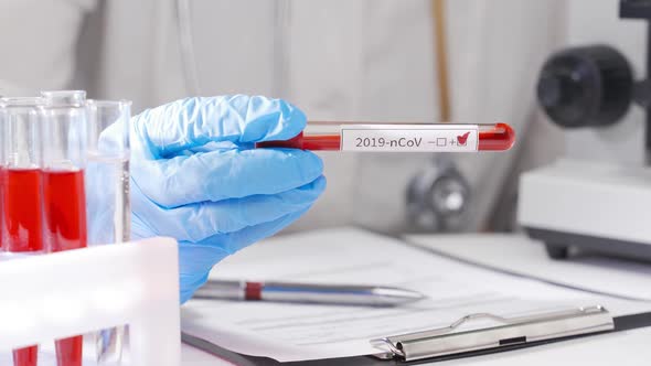 The Doctor Shows in the Camera a Test Tube with Blood