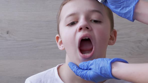 Doctor ENT Pediatrician in Latex Nitrile Gloves Examines Oral Cavity of a Boy