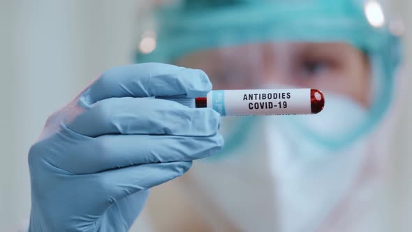 Laboratory with Blood Test with Antibodies of Covid-19 Coronavirus Patient