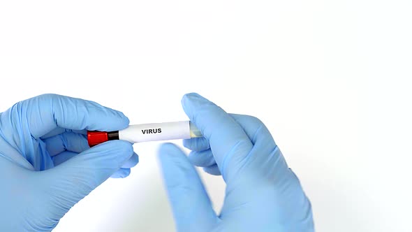 Concept Blood Test. Hands in Blue Gloves, Hold the Tube with Real Blood.