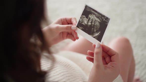 the Hands of a Pregnant Woman Gently Look at the Photo of the Ultrasound