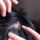 Man split their hair to reveal hair loss - VideoHive Item for Sale