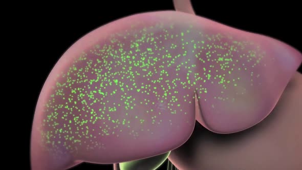 Liver Disease Associated with Viral Infections alt
