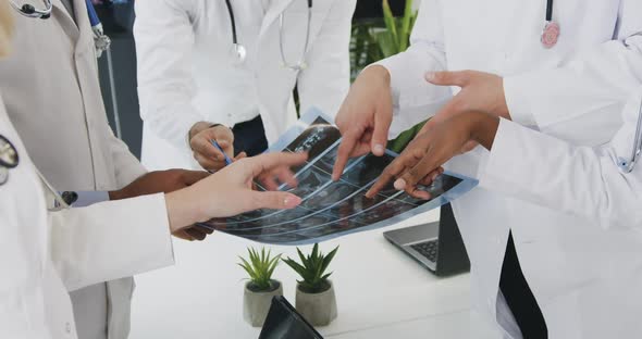 Medical Coworkers in white Uniforms Analyzing Results of x-ray During Meeting