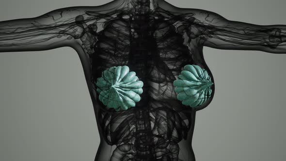Medical Scan of Woman Breast Cancer