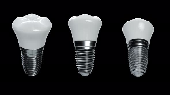 titanium dental implant.