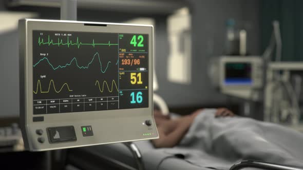 Modern monitoring device is showing the graphs of the sick patients pulse