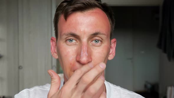 Blue Eyed Man Applies White Burn Cream on Nose with Fingers