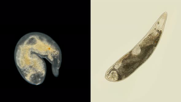 Gyratrix Worm Under a Microscope, Polycystididae Family, Turbellaria Class,