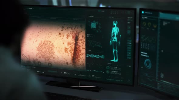 Studying the infection bacteria cells in the patients blood for medical research alt