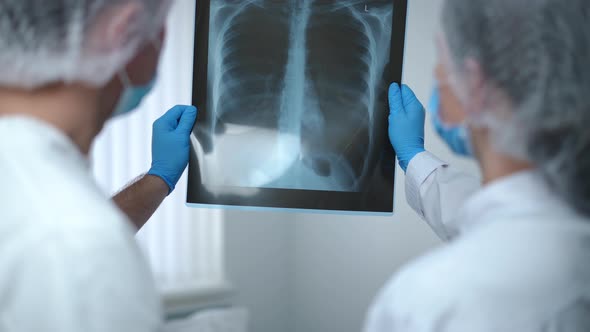 Lungs Xray in Hands of Professional Doctor and Nurse Talking Analyzing Test Result