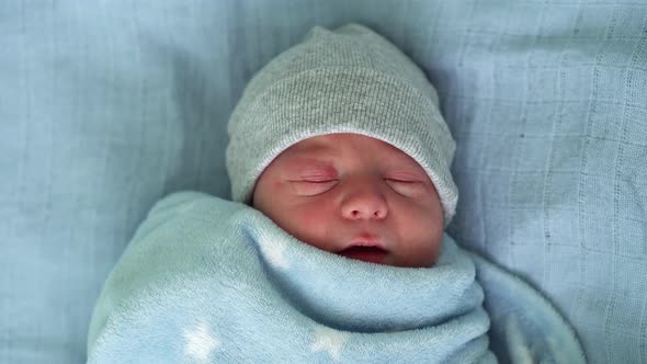 Newborn Baby Face Portrait Acne Allergic Irritations Early Days Sleeping On Blue Background