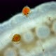 Larva Mite Hydrachnidia and Hydrophilidae Larva Under a Microscope - VideoHive Item for Sale