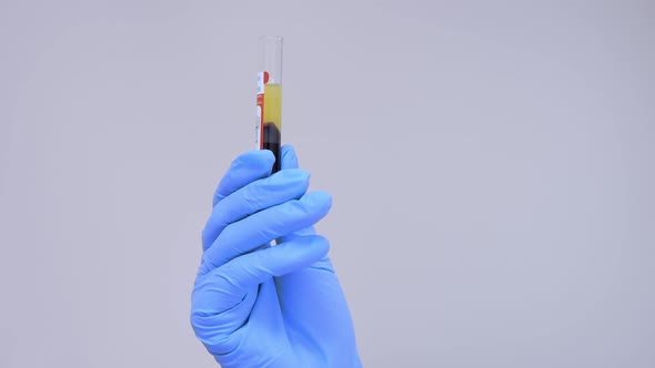 Hand in a Disposable Laboratory Glove Holds a Test Tube with Centrifuged Blood