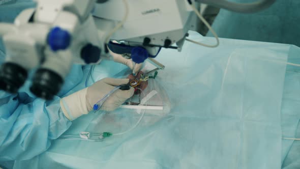 Person Performs Eye Surgery at a Clinic.