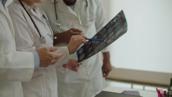 Closeup of Hands of Multiethnic Medical Coworkers Discussing Mri Scan of Ill Patient Indoors