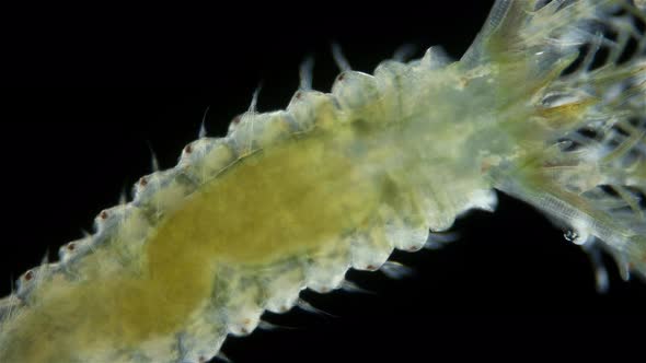 Polychaeta worm, family Sabellidae under a microscope.