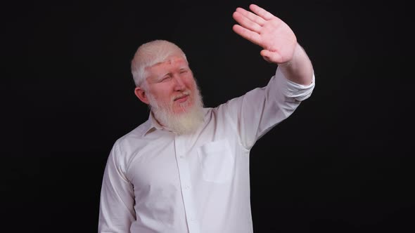 Man with Albinism Raises His Hand To Protect His Eyes From Bright Light