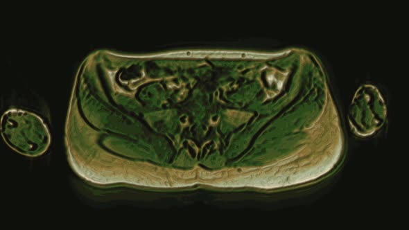 Bulk Multicolored MRI of the Female Pelvic Organs, Abdominal Cavity, Gastrointestinal Tract and