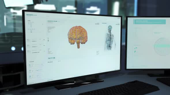 Anatomical Examination By Medical Hospital Diagnostic Scanner Equipment