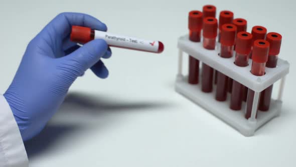 Positive Parathyroid Test, Doctor Showing Blood Sample in Tube, Health Checkup