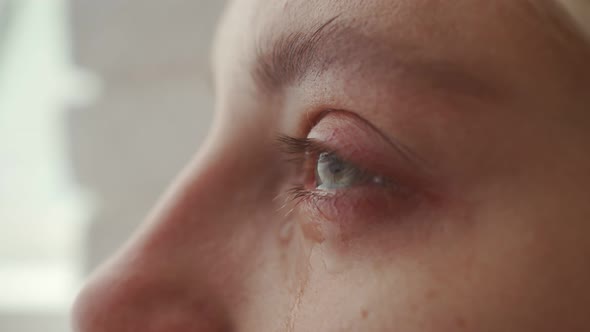 Crying Girl Looks Up To Avoid Crying, Close-up of the Face. Macro Eyes of a Crying Girl