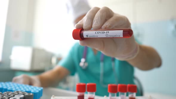 Scientist Holding Test Tube with Blood Sample To Coronavirus. Arm of Laboratory Worker with