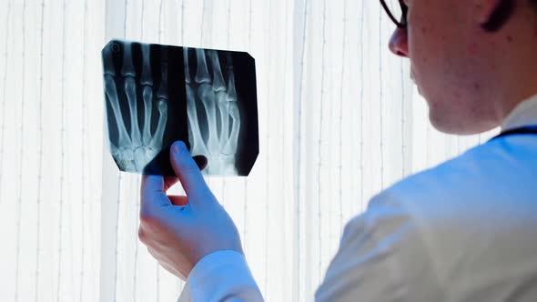 Doctor Looking at Hand Fingers Xray Closeup