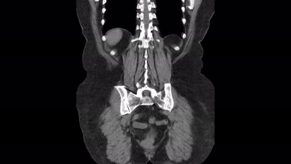 MRI of the Abdominal Cavity, Gastrointestinal Tract, Bladder