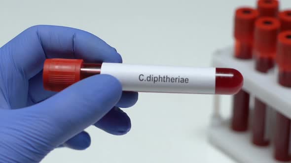 C.diaphtheriae, Doctor Holding Blood Sample in Tube Close-Up, Health Check-Up