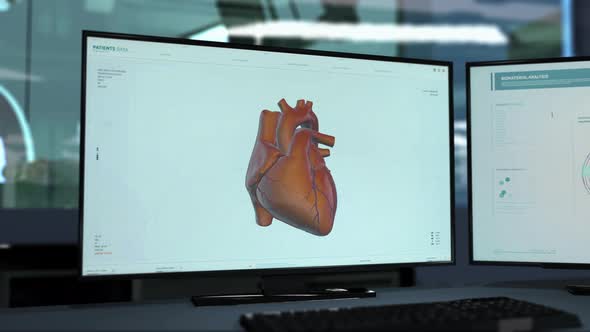 X-ray Scanner At Hospital Diagnosing Patients Heart With Cardiac Ischemia alt