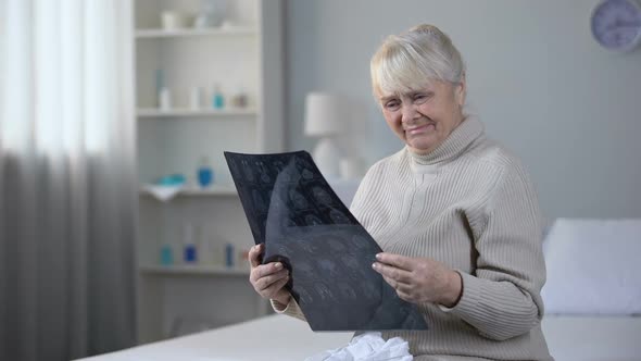Depressed Old Lady Looking at Brain X-Ray and Crying, Incurable Disease, Health