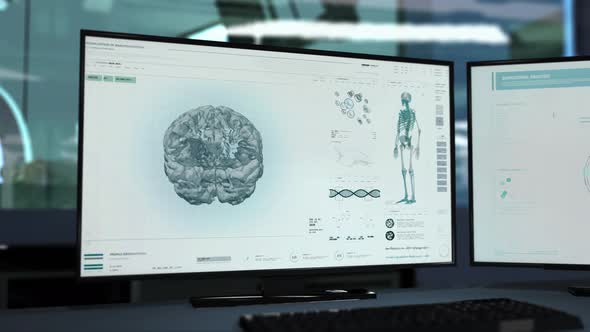 Dangerous Brain Cancer Tumor X-ray Examination At An Oncological Laboratory