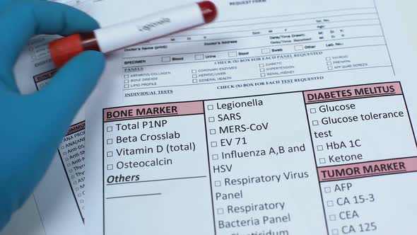 Legionella, Doctor Checking Bacteria Name in Lab Blank, Showing Blood Sample