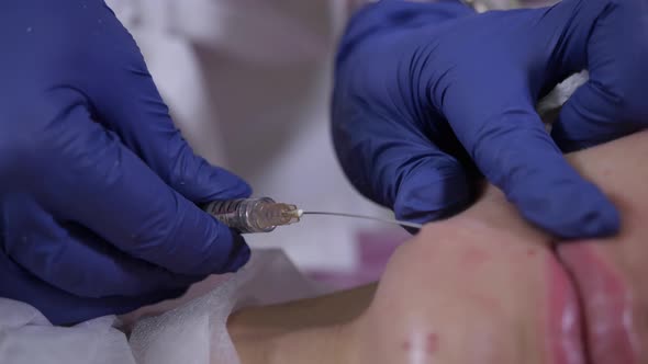 The Doctor of the Beautician Conducts a Cosmetic Procedure with a Syringe