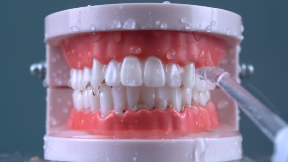 Teeth Cleaning Water Pressure