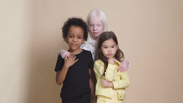 Three Diverse Children with Unusual Appearance Hug Each Other, Posing.