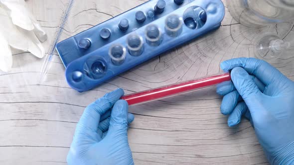 Top View of Laboratory Technician Hand Holding Blood Test Tube 