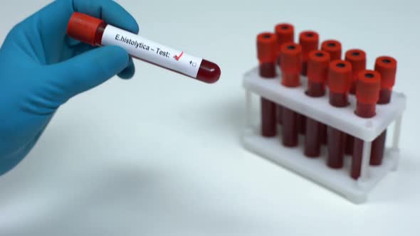 Negative E Histolytica Test, Doctor Showing Blood Sample Lab Research Healthcare