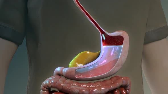 dissolutionofthedruginthestomach5.mov alt