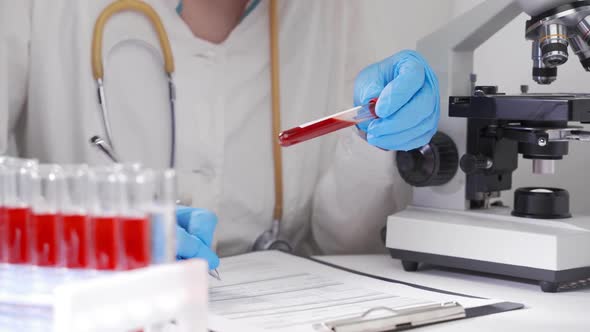 The Doctor Examines the Patient’s Blood Test and Writes the Results on a Form. Modern Laboratory