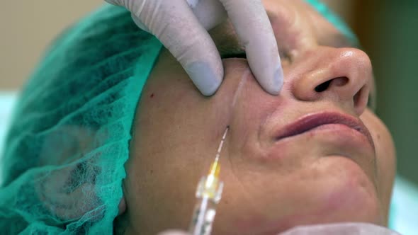 Adult Woman 40S50s Getting Medical Treatment Injections of Botox Into Cheek for Smoothing By Doctor