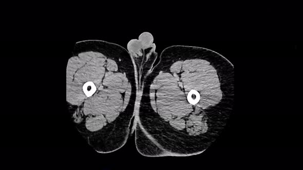 Computed Medical Tomography MRI Upscaled Scan of Human Illness alt