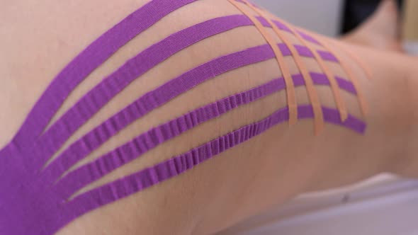 Close Up Kinesiology Taping