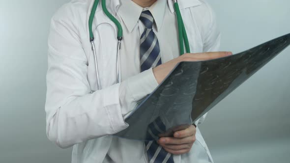 Doctor Examining The X Ray Of The Brain In A Modern Hospital